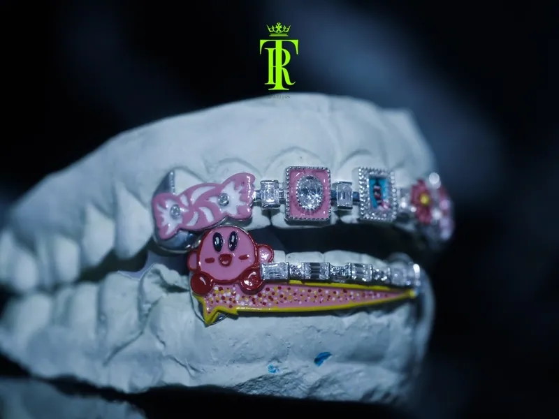 Character grillz set on a dental cast, wider view
