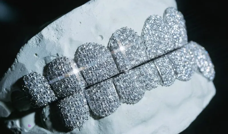 Fully stone-set top and bottom grillz on a dental cast